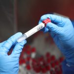 Proceso de pruebas PCR por parte de la UCE